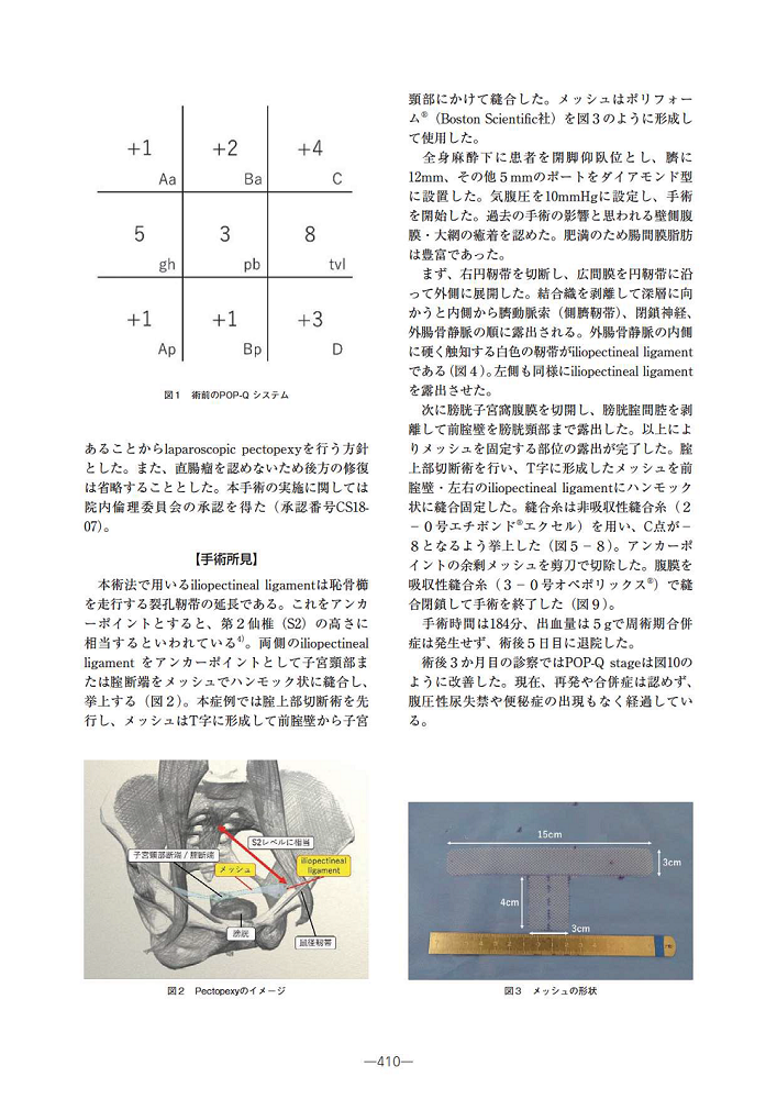日本髂耻11_页面_2.png